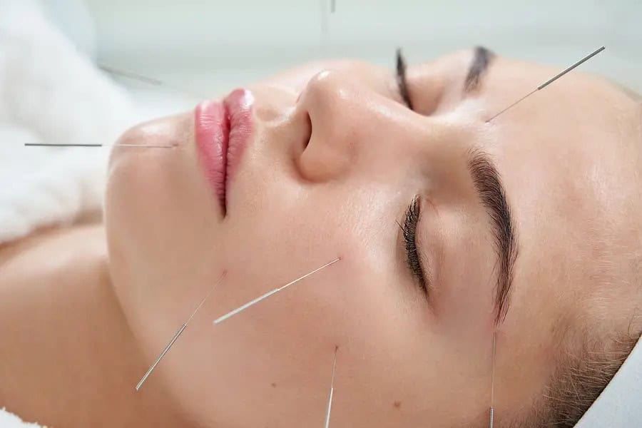 dental-acupuncture-in-beverly-hills-ca