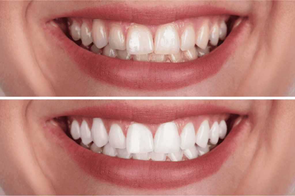 teeth teeth