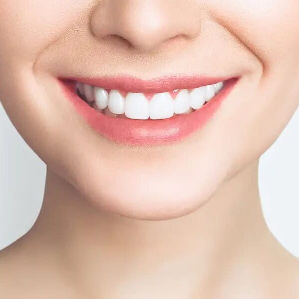 cosmetic-dentistry-in-beverly-hills-ca