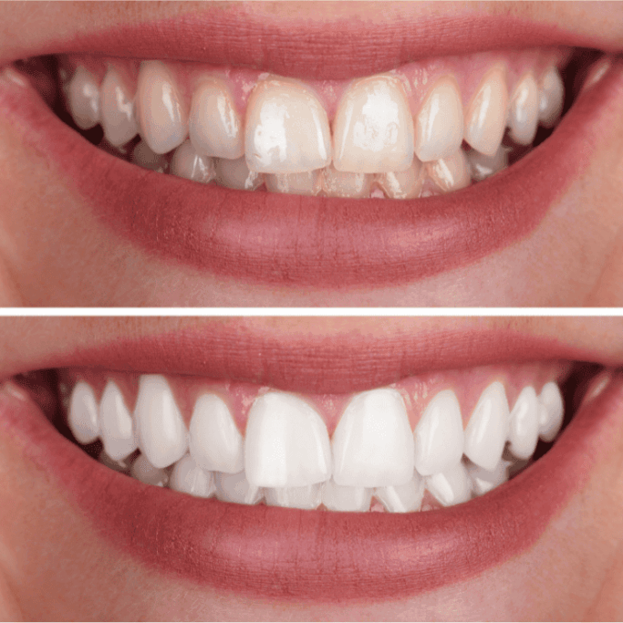 teeth